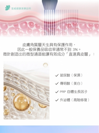 毛孔粗大、凹疤救星？揭開「微針筆 Microneedling」煥膚原理：比雷射更溫和的物理性修復選擇