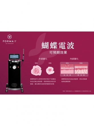 FORMA V 蝴蝶電波｜南港私密保養推薦：專業女醫師團隊 - 荃威健康美學診所
