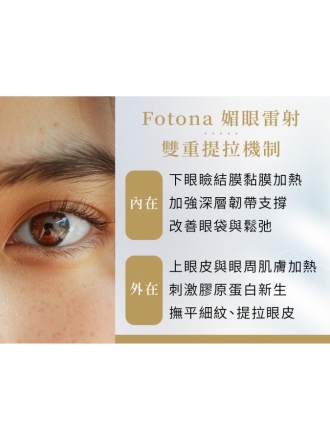 Fotona 媚眼雷射｜告別眼皮下垂與眼周細紋，重塑明亮緊緻雙眸｜荃威診所